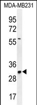 Rabbit Polyclonal Antibody to TNFAIP8L3