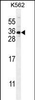 Rabbit Polyclonal Antibody to STARD6