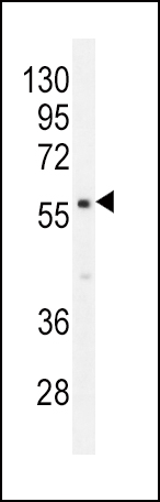 Rabbit Polyclonal Antibody to PDE1B