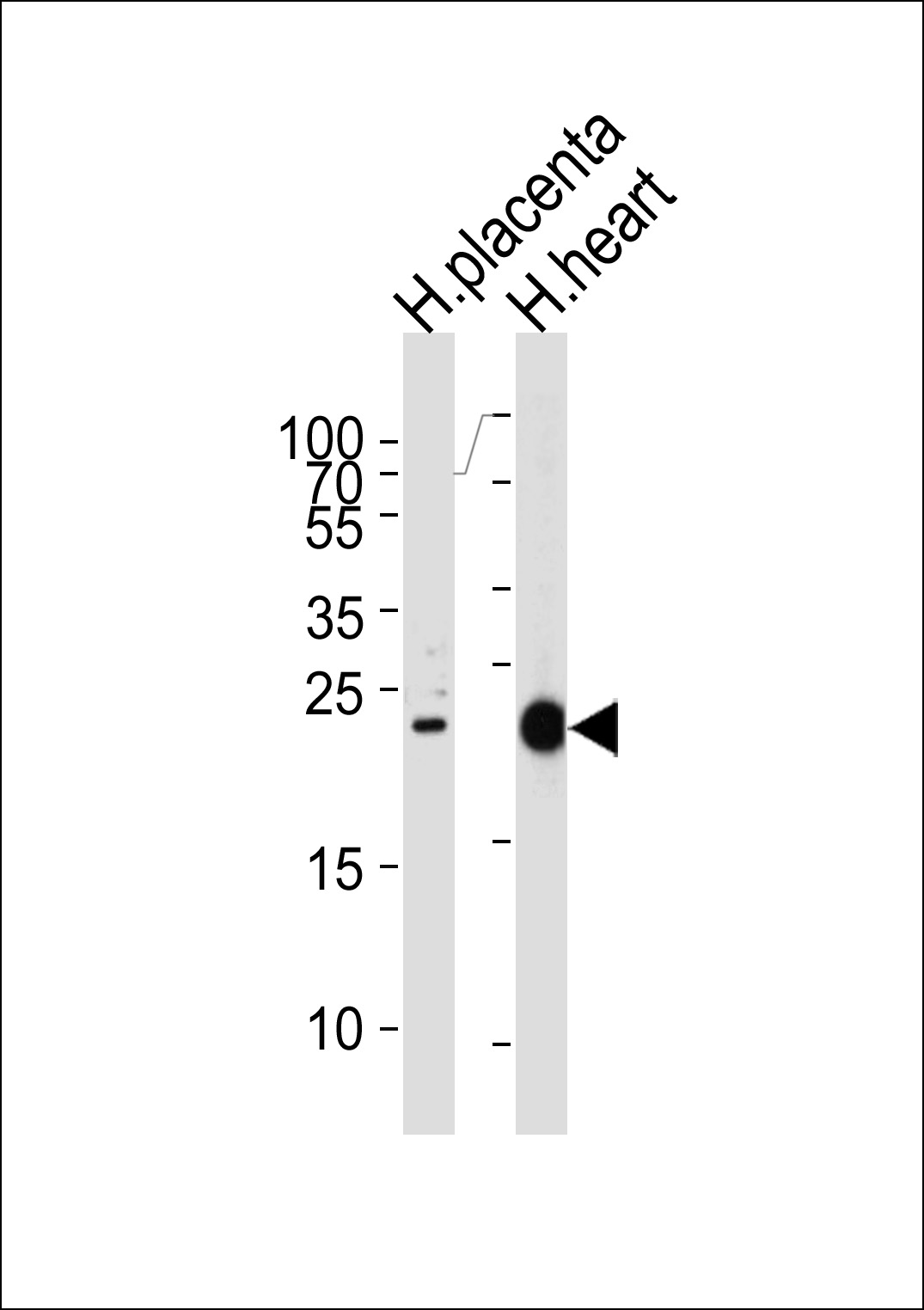 Rabbit Polyclonal Antibody to FRAT2