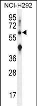 Rabbit Polyclonal Antibody to COL13A1 (N-term)