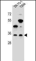 Rabbit Polyclonal Antibody to GPM6B (N-term)