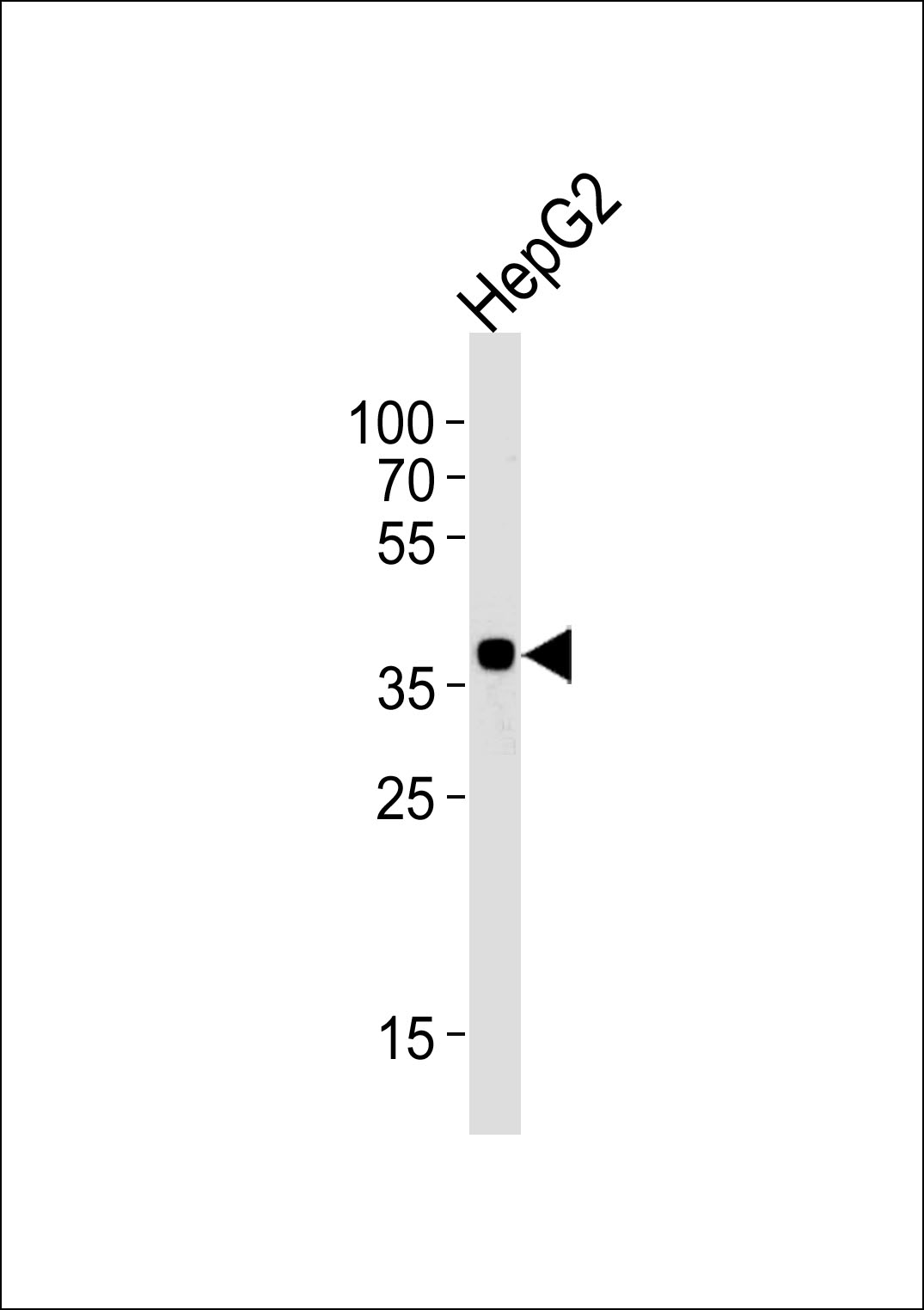Rabbit Polyclonal Antibody to OR2M7