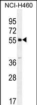 Rabbit Polyclonal Antibody to SHISA6 (N-term)