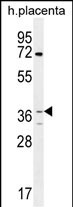 Rabbit Polyclonal Antibody to OR2AT4