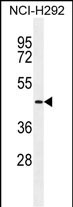 Rabbit Polyclonal Antibody to TMPRSS11E2