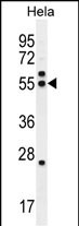 Rabbit Polyclonal Antibody to TBB8B
