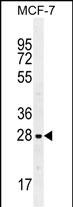 Rabbit Polyclonal Antibody to LGALS3