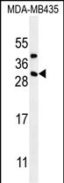 Rabbit Polyclonal Antibody to CD8B1