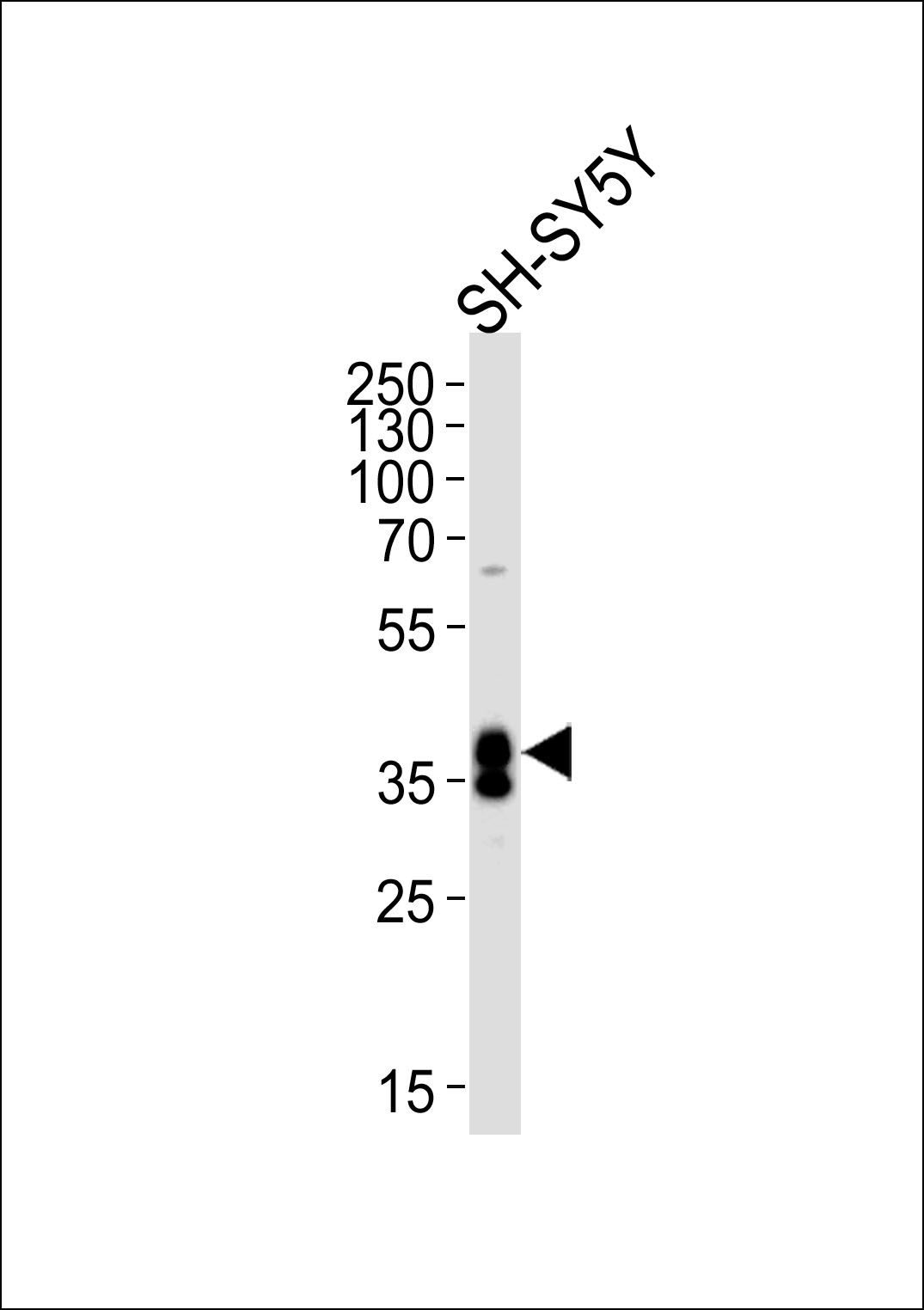 Rabbit Polyclonal Antibody to MSI1 (N-term)