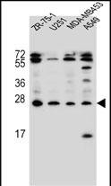 Rabbit Polyclonal Antibody to EDN1