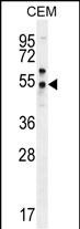 Rabbit Polyclonal Antibody to PSMAL