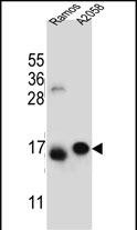 Rabbit Polyclonal Antibody to EIF5AL1