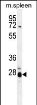 Rabbit Polyclonal Antibody to IL17B
