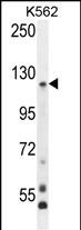 Rabbit Polyclonal Antibody to PCDHGA8