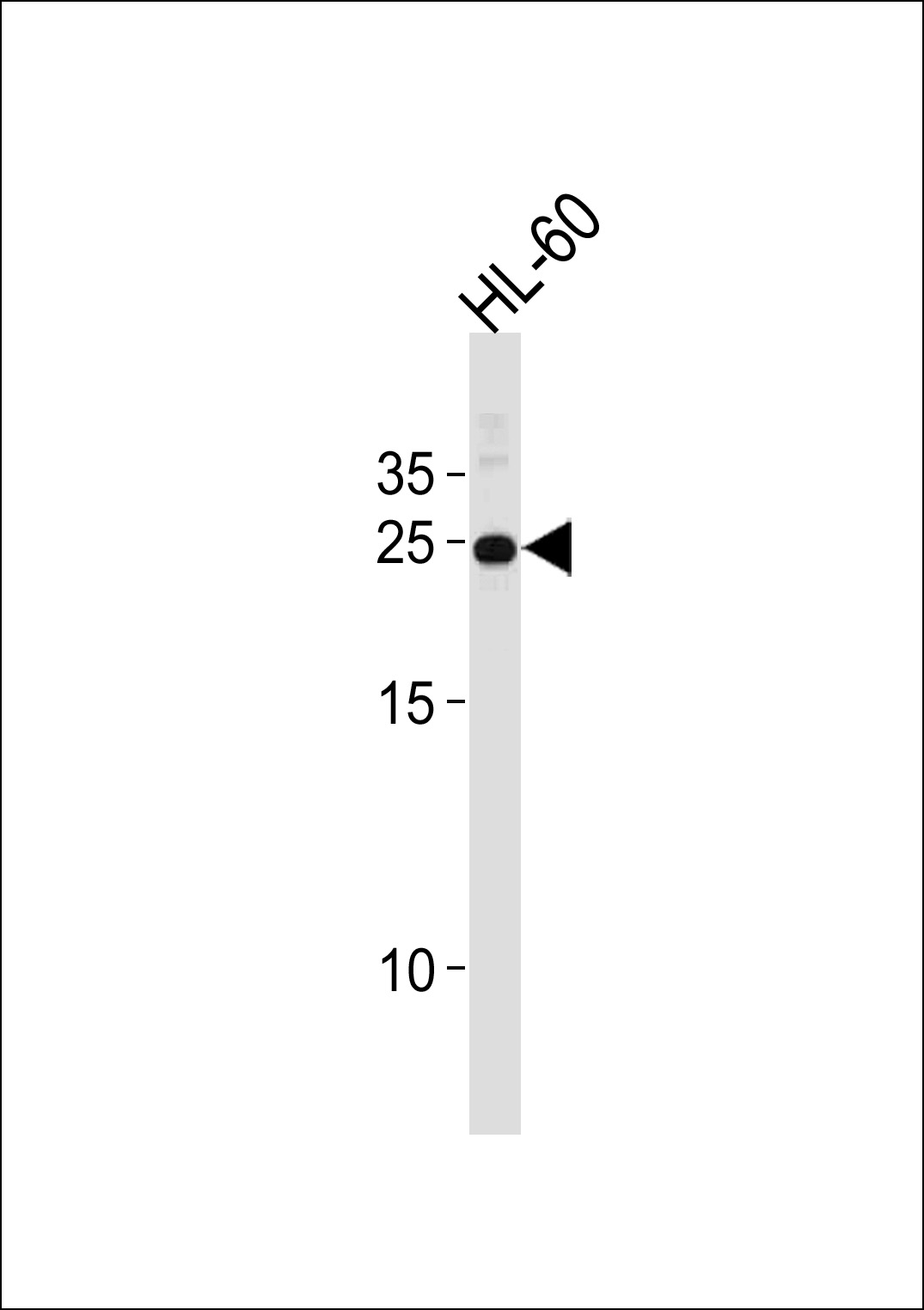 Rabbit Polyclonal Antibody to HOXA6