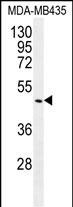 Rabbit Polyclonal Antibody to GDF5
