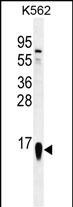 Rabbit Polyclonal Antibody to RPS19