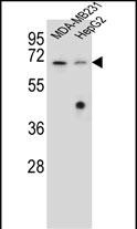 Rabbit Polyclonal Antibody to GLMN