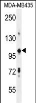 Rabbit Polyclonal Antibody to TRIM33