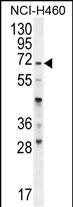 Rabbit Polyclonal Antibody to FUT4