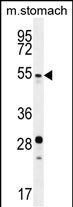 Rabbit Polyclonal Antibody to SUV4-20H2 (N-term)
