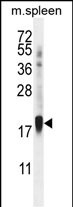 Rabbit Polyclonal Antibody to ZNF593