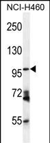 Rabbit Polyclonal Antibody to ENPEP