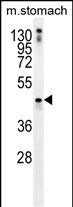 Rabbit Polyclonal Antibody to TRIM69  (N-term)