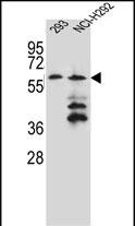 Rabbit Polyclonal Antibody to PRAMEF12