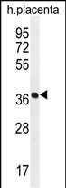 Rabbit Polyclonal Antibody to OR5AS1