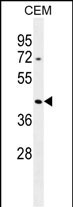 Rabbit Polyclonal Antibody to ACTBL3 (N-term)