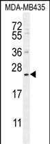 Rabbit Polyclonal Antibody to FAM109A (N-term)