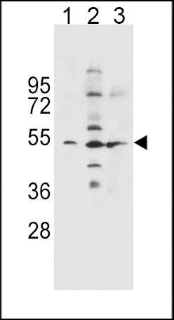 Rabbit Polyclonal Antibody to SLC36A1 (N-term)