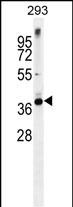 Rabbit Polyclonal Antibody to STX16