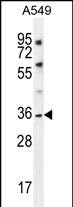 Rabbit Polyclonal Antibody to KCNK1