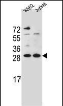 Rabbit Polyclonal Antibody to HMG1L10 (N-term)