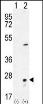 Rabbit Polyclonal Antibody to VSNL1