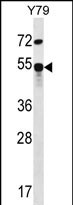 Rabbit Polyclonal Antibody to ZFP14 (N-term)