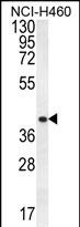 Rabbit Polyclonal Antibody to CCNYL3 (N-term)