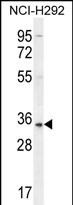 Rabbit Polyclonal Antibody to SFTPA2B