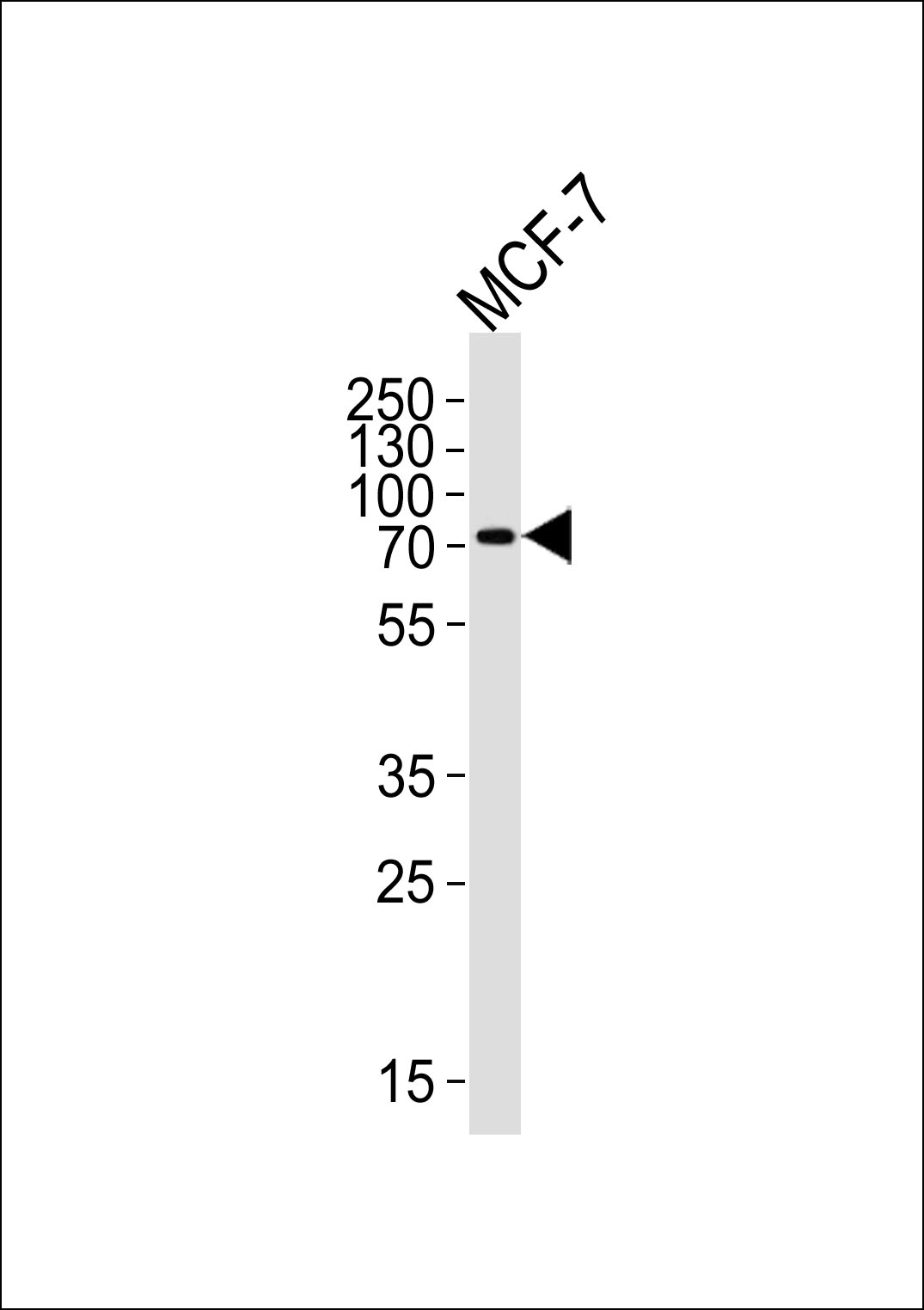 Rabbit Polyclonal Antibody to KLC2 (N-term)