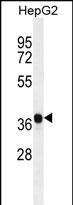 Rabbit Polyclonal Antibody to AKR1C2