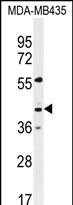 Rabbit Polyclonal Antibody to GPR45