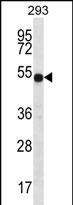 Rabbit Polyclonal Antibody to ATP6V1B1
