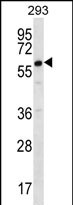 Rabbit Polyclonal Antibody to DAZ2