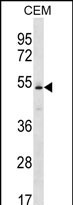 Rabbit Polyclonal Antibody to KCNJ4 (N-term)