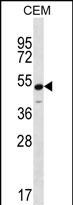 Rabbit Polyclonal Antibody to KCNJ8 (N-term)