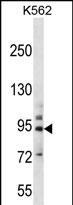 Rabbit Polyclonal Antibody to PCDHB14 (N-term)