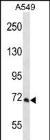 Rabbit Polyclonal Antibody to PCCA